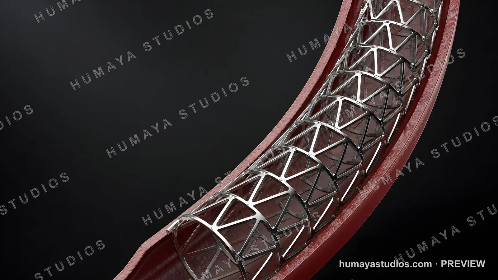 Coronary Stent in Artery 3D Illustration Medical Render